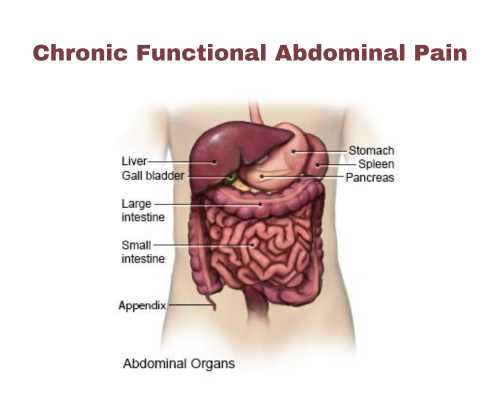 Chronic Functional Abdominal Pain